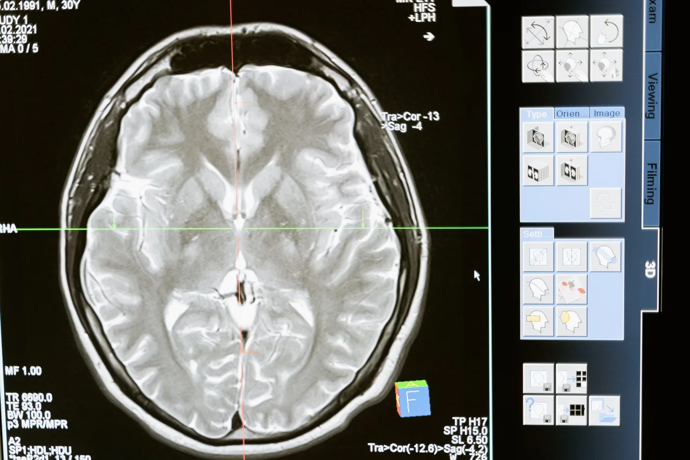 Neurologické vyšetření pomáhá odlišit epilepsii od jiných stavů.