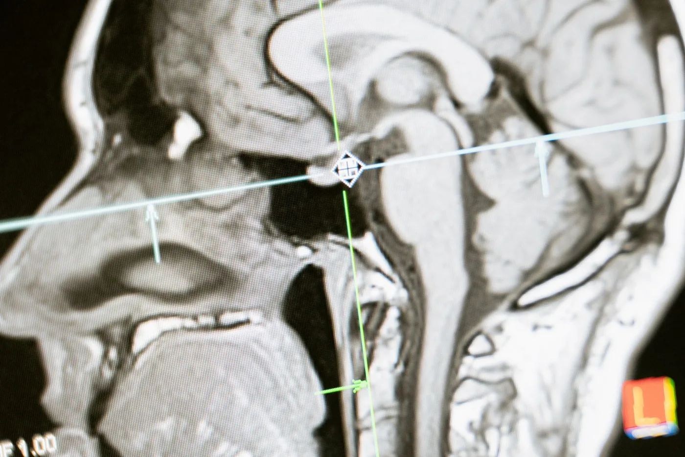 Detail snímku mozkové aktivity při neurologickém vyšetření.